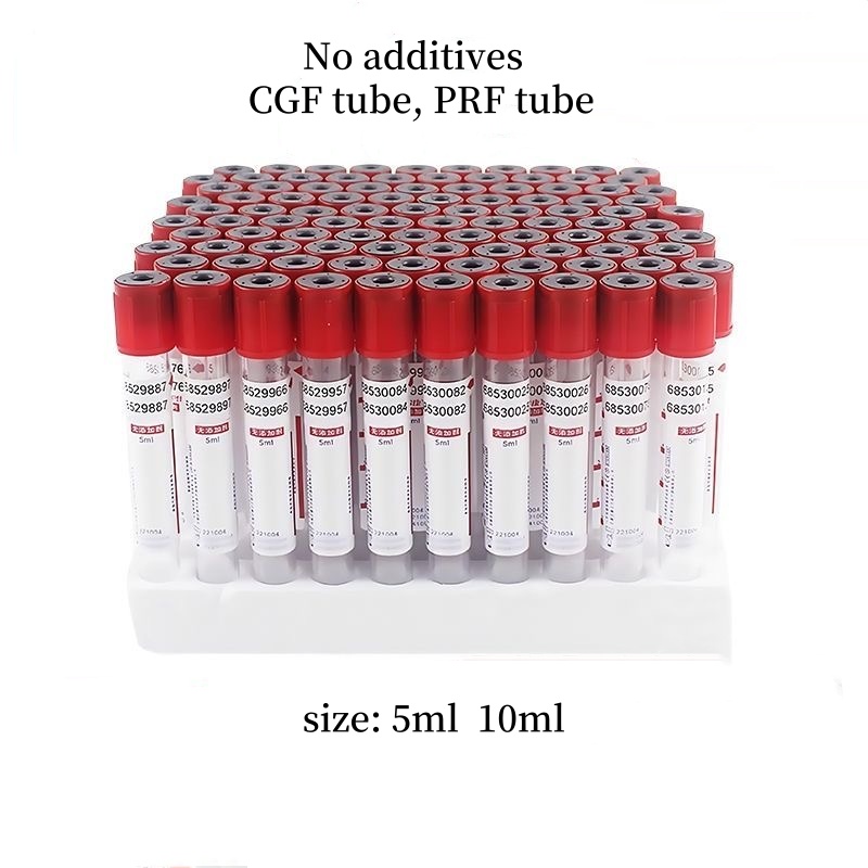Disposable Sterile Red Top Blo - Medical Lab Blood Test 리뷰 및 가격