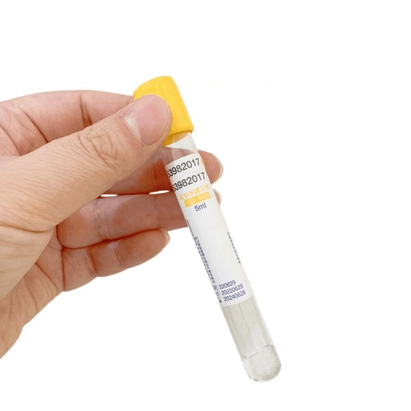 Disposable Vacuum Blood Collec - Medical Lab Blood Test 리뷰 및 가격